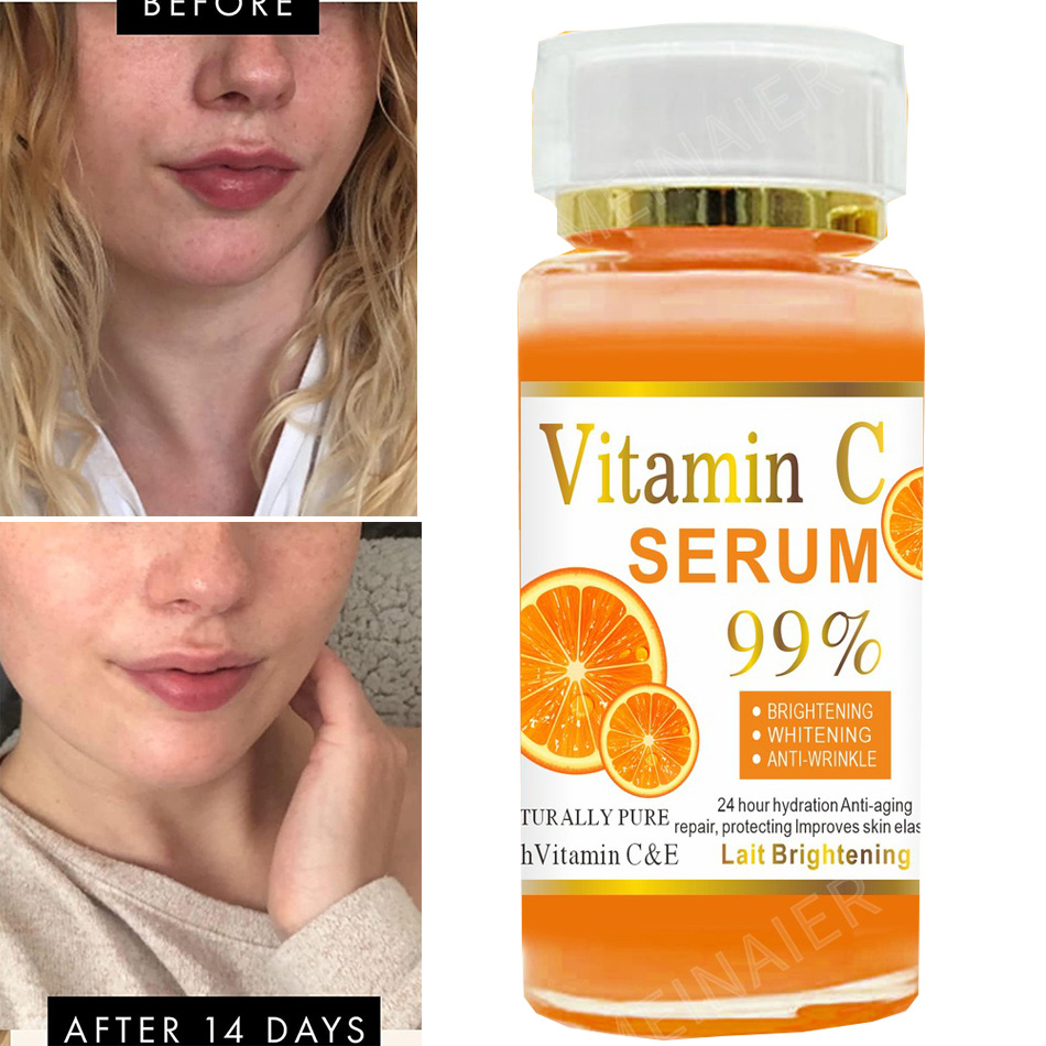 Super 120ml vitamina c soro an - Vitamin C Serum Face avaliação e preço