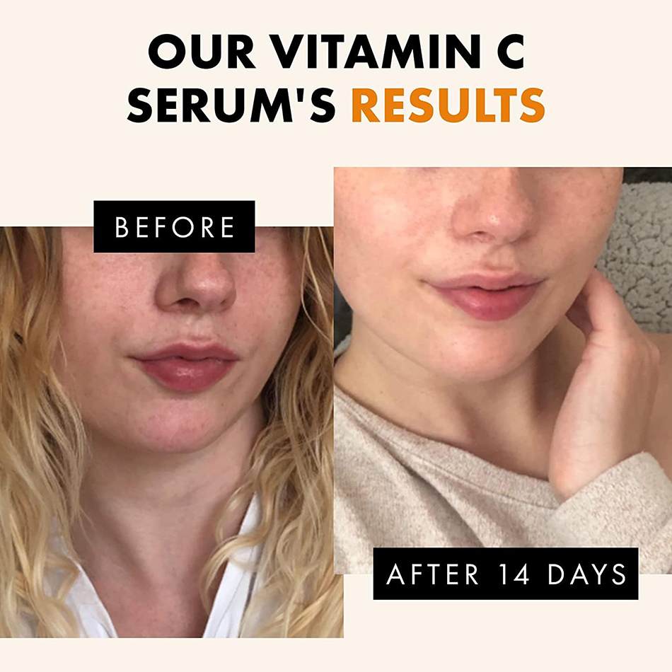 Super 120ml vitamina c soro an - Vitamin C Serum Face avaliação e preço